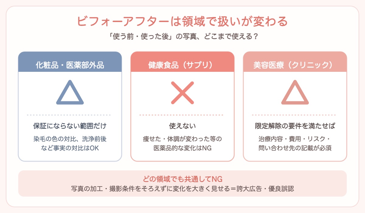 ビフォーアフター写真が領域ごとに使えるかどうかを示した図解。化粧品・医薬部外品は△で効果・安全性を保証しない範囲だけ、健康食品は×で医薬品的な効果のビフォーアフターは不可、美容医療は△で限定解除4要件と治療内容・費用・リスクの記載があれば可。共通してNGなのは写真の加工・撮影条件をそろえない見せ方